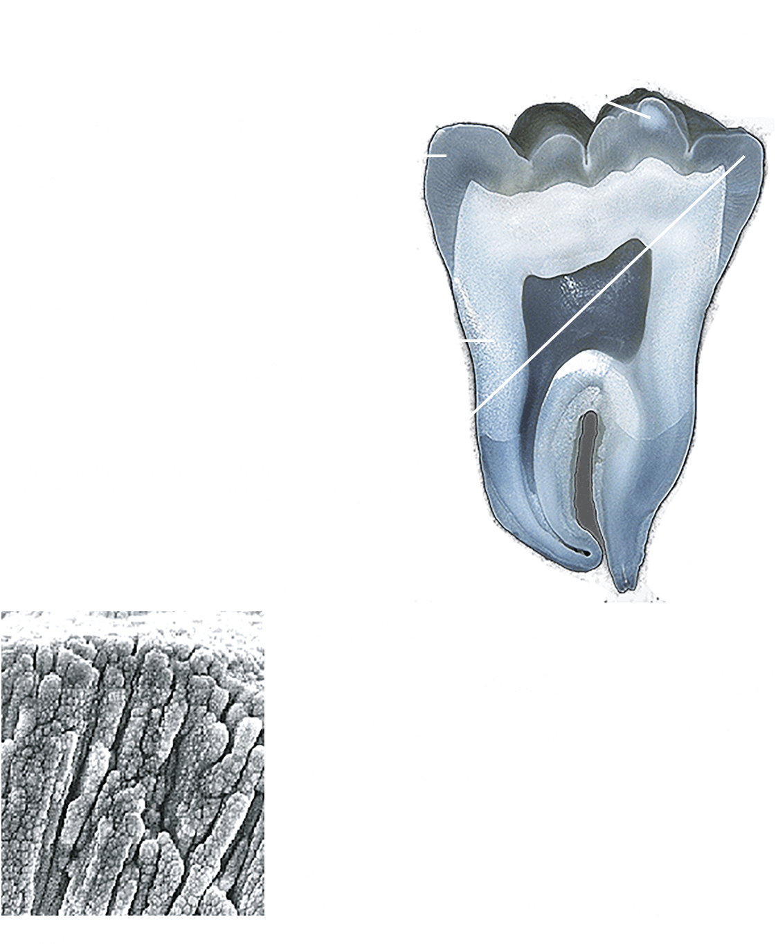̐ؕЎʐ^pGiEۉ县̐}
          GiƂ 炩Ɍ鎕̕\ʂ́A̐jW܂悤ȃGiȂA̓fP[gȑgD