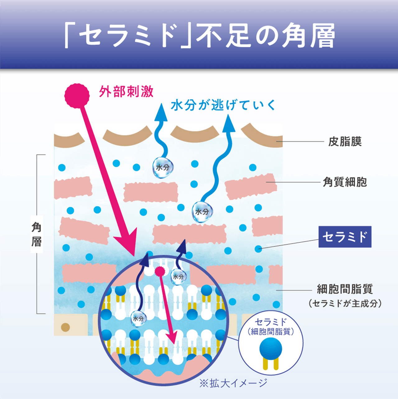 「セラミド」不足の角層