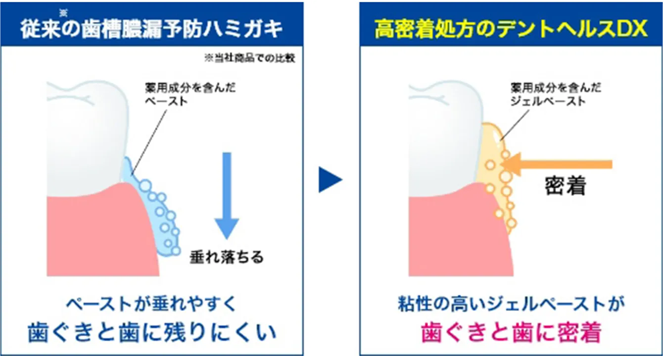 従来の歯槽膿漏予防ハミガキ※当社商品での比較 薬用成分を含んだベースト 垂れ落ちる ペーストが垂れやすく 歯ぐきと歯に残りにくい 高密着処方のデントヘルスDX 薬用成分を含んだジェルペースト 密着粘性の高いジェルペーストが歯ぐきと歯に密着