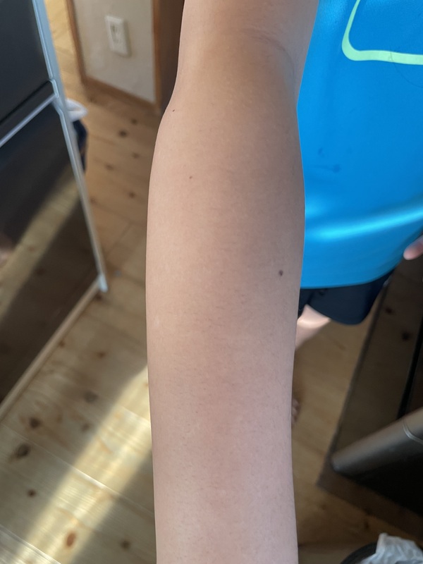 ��p�C�r�T�w�A�[�����[�o���N���[���y��򕔊O�i�z1�{