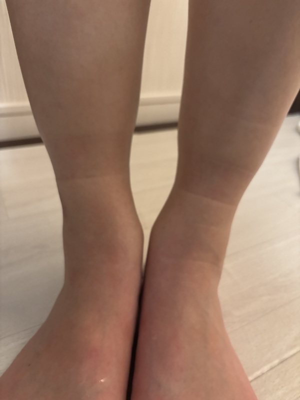 �X�����o�[���X�N�������M���XS�T�C�Y×4��