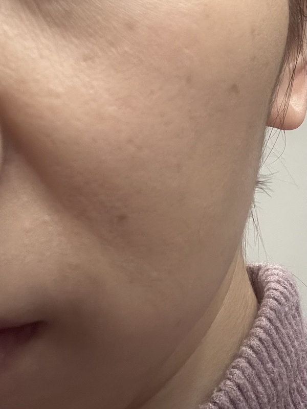 �s�R�����e �r���[�e�B�t�� �R���V�[���[ �I�[�N��×4�{