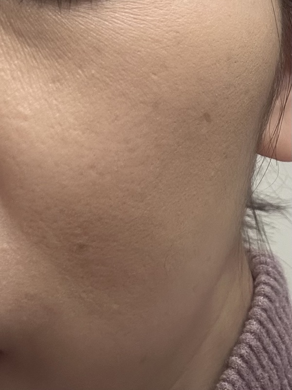 �s�R�����e �r���[�e�B�t�� �R���V�[���[ �I�[�N��×4�{